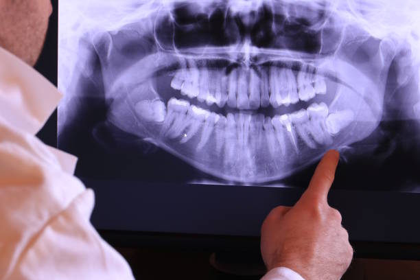 Best Emergency Dental Extractions in Indian Head Park, IL