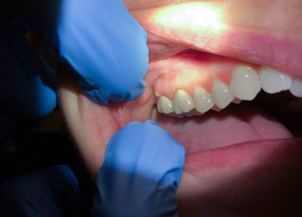 Best Orthodontic Emergency Dentist in Indian Head Park, IL